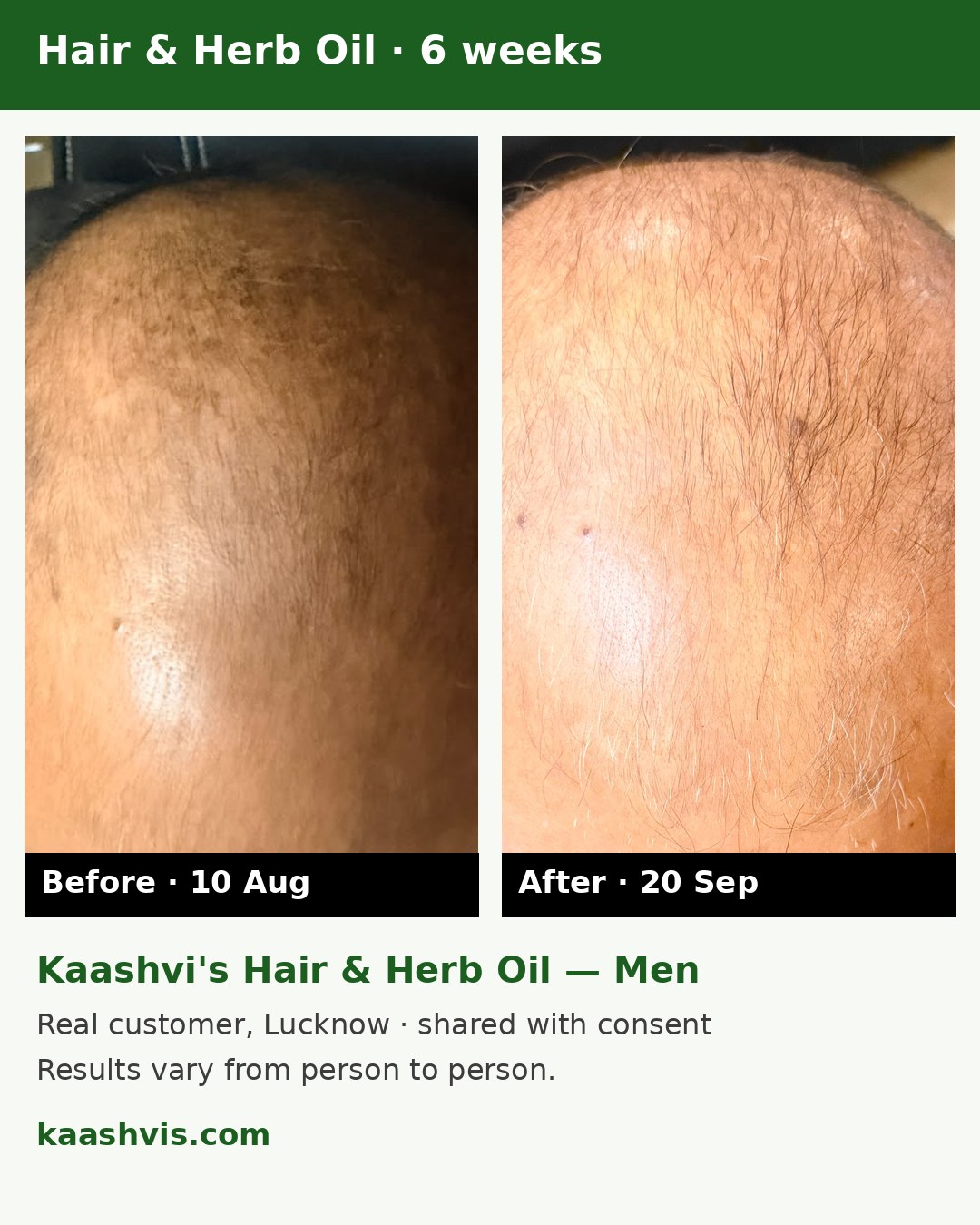 Real customer before and after, Kaashvi Hair & Herb Oil Men