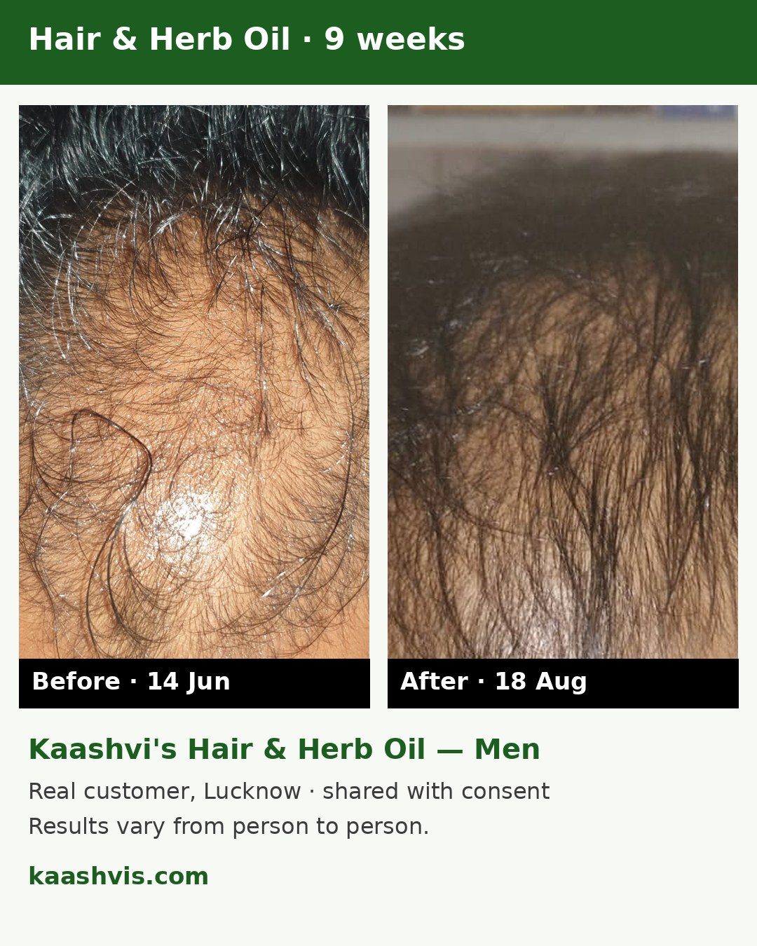 Real customer before and after, Kaashvi Hair & Herb Oil Men